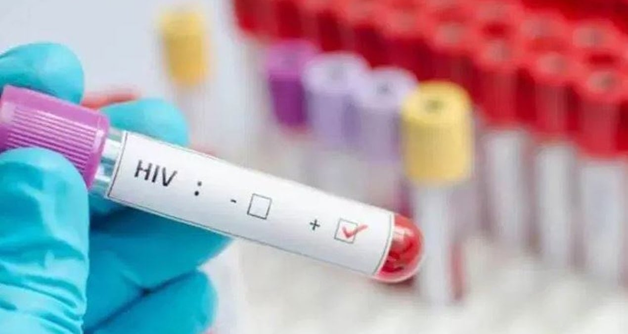 400 erkege bilerek hiv virusunu bulastirdi ulkede herkes panige kapildi vBNivAv9